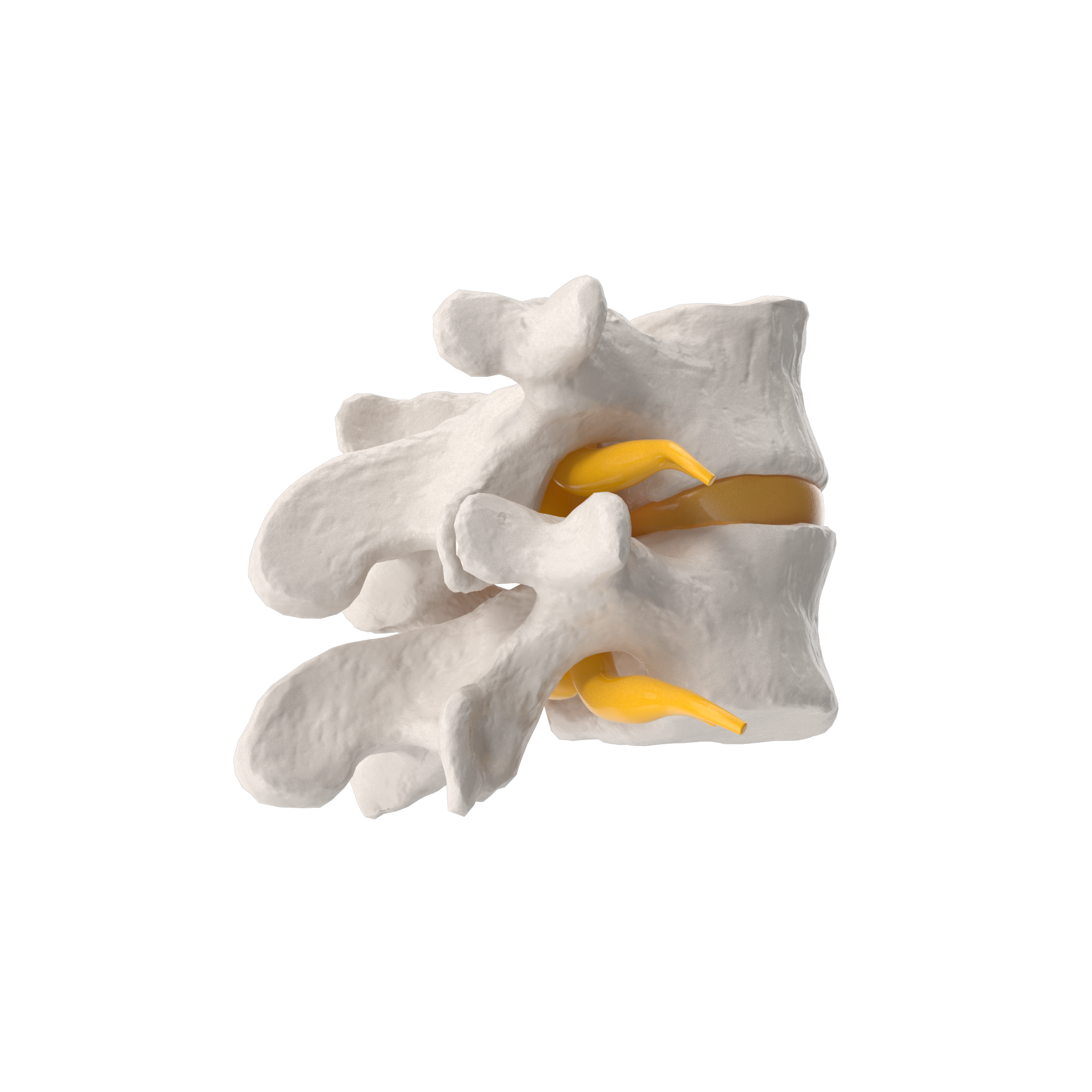 Part Of Spinal Column With Hernia.J12.2k
